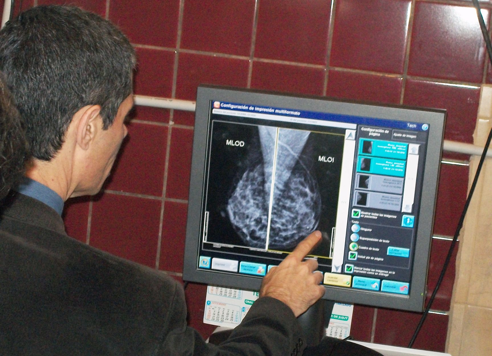 241016 Cancer de Mama 07