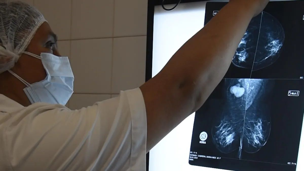 Mamografías en Hospital Pablo Soria se realizan también por la tarde