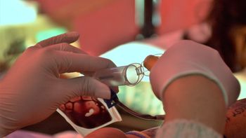 la dificultad en la coagulacion es la principal caracteristica de la hemofilia la dificultad en la coagulacion es la principal caracteristica de la hemofilia