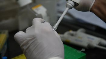 se confirmo el primer caso de viruela simica en la provincia