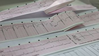en dos meses, la red iam duplico la respuesta a personas con infarto en dos meses, la red iam duplico la respuesta a personas con infarto